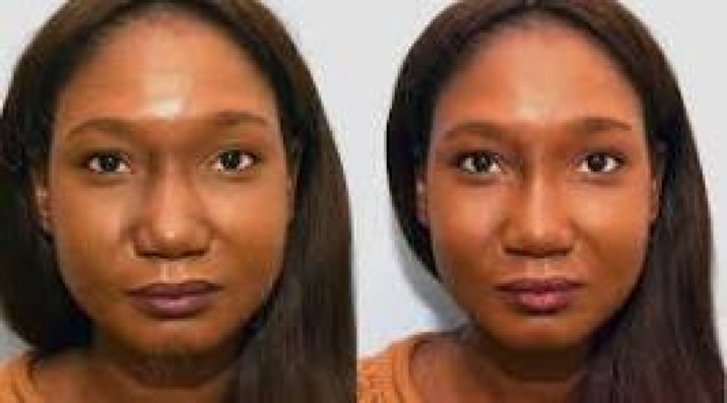 Agents de comblement (Fillers)